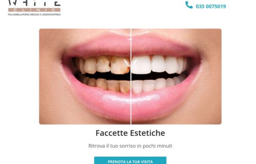 Landing page per faccette estetiche dentali